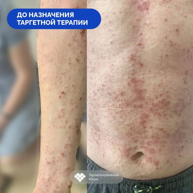 � ������ �� ��������: ���������� ����� ������� ��������� � ��������� ������������