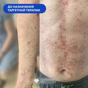 � ������ �� ��������: ���������� ����� ������� ��������� � ��������� ������������