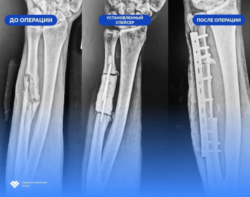 ���������� ����� ������ ���� ��������� ���: ��������� ���������� ��������