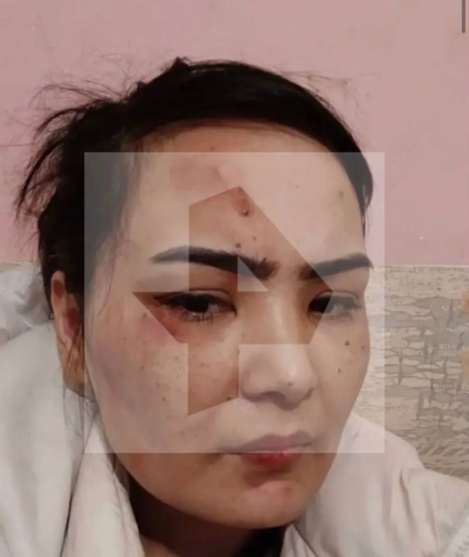 "10 лет меня мучает лилипут из Сургута, который работает в детском саду": женщина заявила о многолетнем преследовании и шантаже сожителя "10 лет меня мучает лилипут из Сургута, который работает в детском саду": женщина заявила о многолетнем преследовании и шантаже сожителя